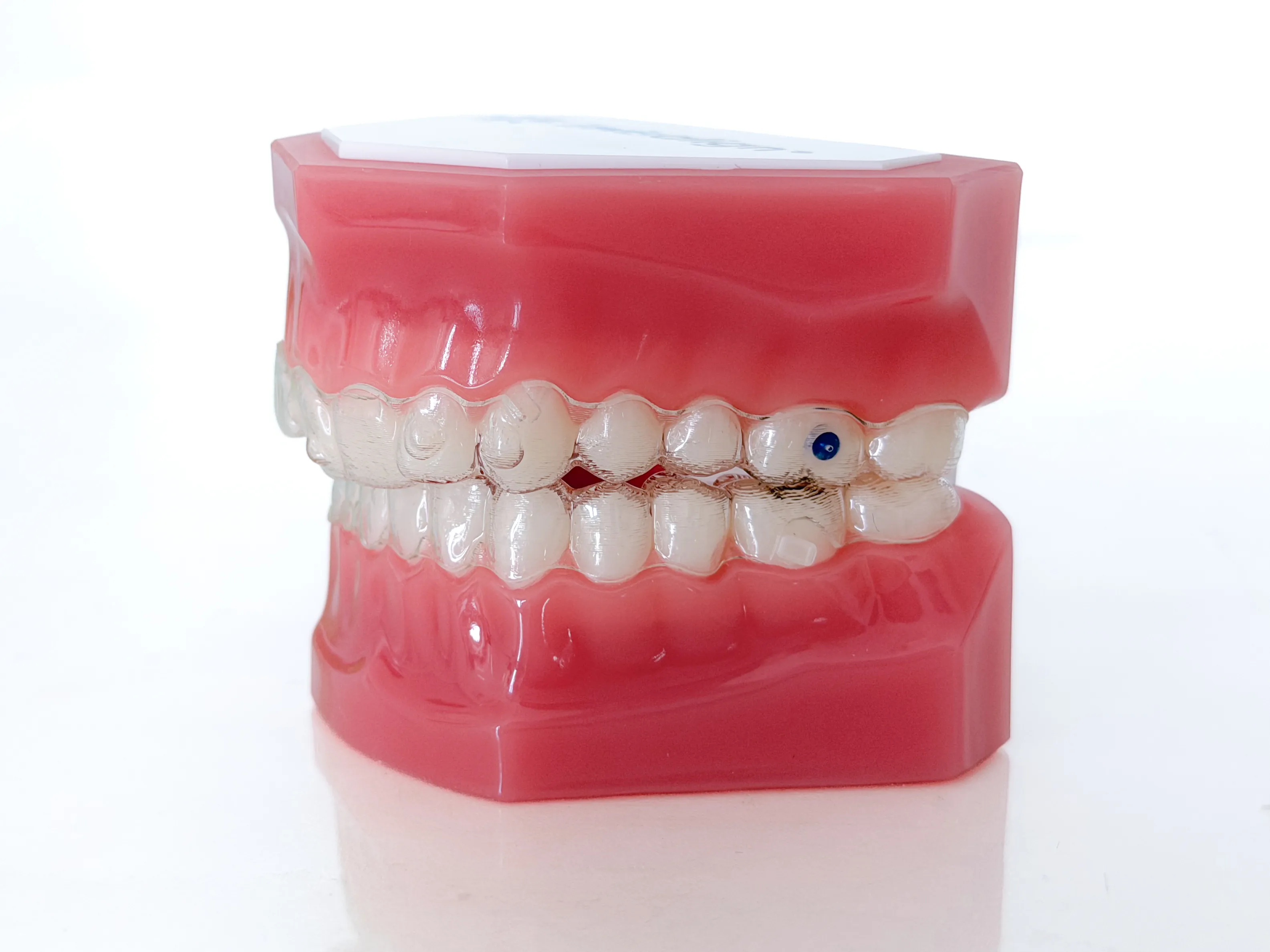 Prozirni aligner Invisalign za ispravljanje položaja zuba